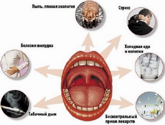 От чего может начаться аллергический фарингит