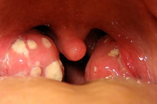 gnofarin4.jpg