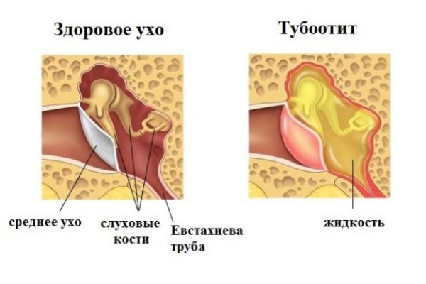 tubootit-u-rebenka2-e1495628634213.jpg