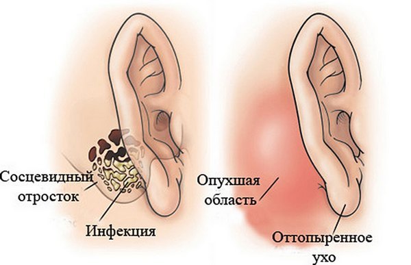 Внешние проявления осложнения