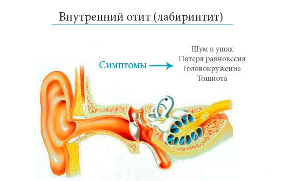 Симптомы и схема