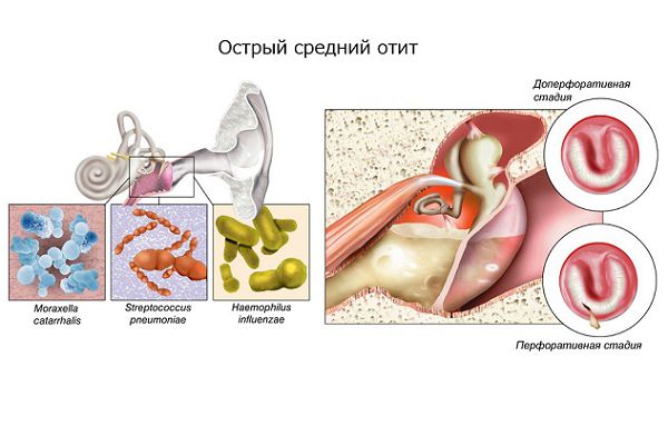 Анатомия болезни