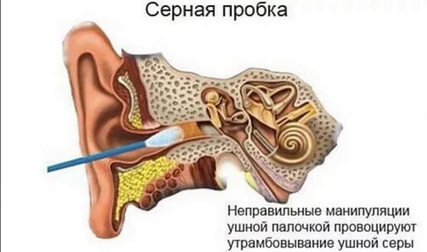 Анатомия уха